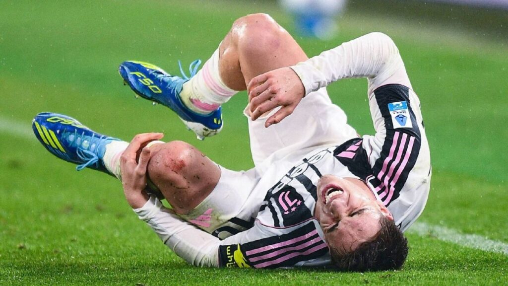 Yildiz con la maglia della Juventus